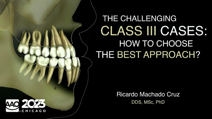Challenging Class III Cases: How to Choose the Best Approach