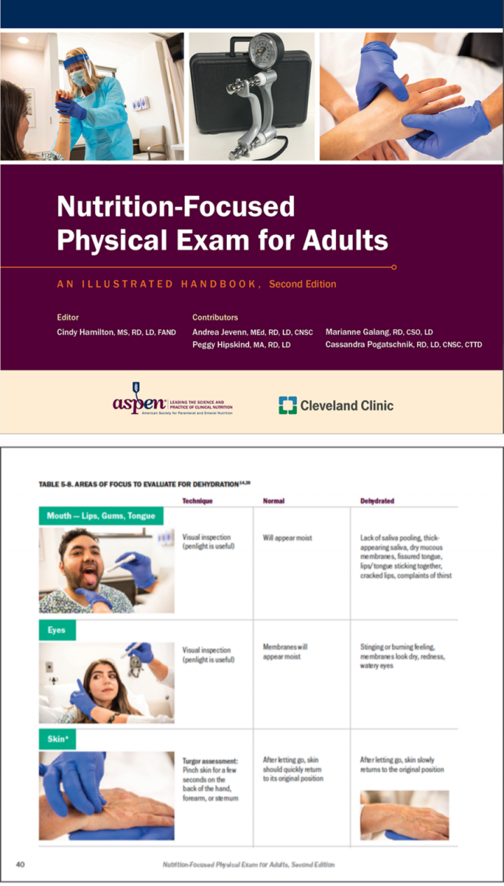 Nutrition-Focused Physical Exam for Adults: An Illustrated Handbook, Second Edition