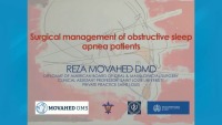 Surgical Modalities in the Management of Obstructive Sleep Apnea icon