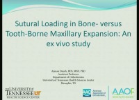 Sutural Loading In Bone- vs. Tooth-borne Maxillary Expanders: An Ex-vivo Study icon