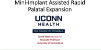 Mini Implant Assisted Rapid Palatal Expansion icon