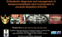 Orthodontic Diagnosis and Management of Temporomandibular Joint Involvement in Juvenile Idiopathic Arthritis icon