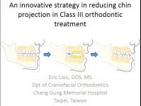 An Innovative Strategy in Reducing Chin Projection in Class III Orthodontic Treatment  icon