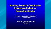 2007 - AAO Interdisciplinary Conference - Maxillary Posterior Osteotomies to Maximize Esthetic or Restorative Results