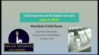 2018 AAO Annual Session - Tooth Impaction and the Hooked Root Apex: Cause or Effect?