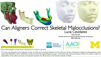 2019 AAO Annual Session - Can Aligners Correct Skeletal Malocclusions?