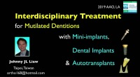2019 AAO Annual Session - Interdisciplinary Treatment for Mutilated Dentitions with Mini-implants, Dental implants and Autotransplants