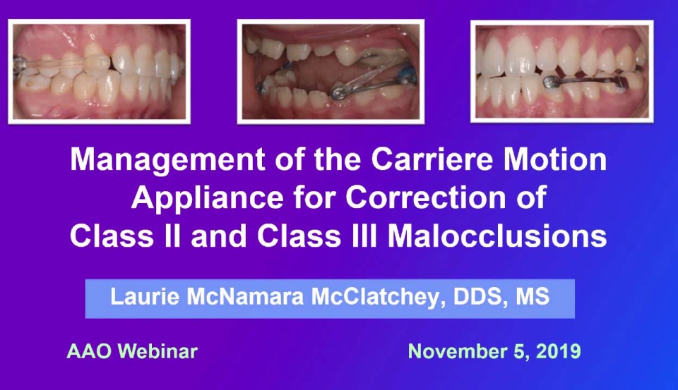 2019 Webinar - Management of the Carriere Motion Appliance Prior to Treatment with Fixed Appliances or Clear Aligners