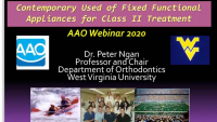 2020 Webinar - Contemporary Use of Fixed Functional Appliances for Treatment of Class II Malocclusions