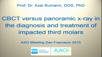 CBCT vs Panoramic X-ray in the Diagnosis and Treatment of Impacted Third Molars