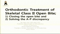 Orthodontic Treatment of Skeletal Class II Open Bite icon