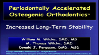 Periodontally Accelerated Osteogenic Orthodontics icon