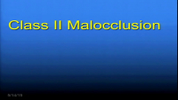 Class II Malocclusion: Early or Late, Fixed or Functional, Most Roads Lead to the Midface