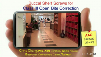 Buccal Shelf (BS) Screws for Class III Openbite Correction