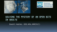 Solving the Mystery of the Anterior Open Bite in Adults