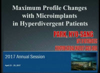 Maximum Facial Profile Changes in Hyperdivergent Patients