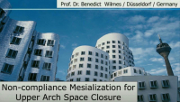 Non-compliance Mesialization for Upper Arch Space Closure