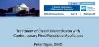 Treatment of Class II Malocclusion with Contemporary Fixed Functional Appliances