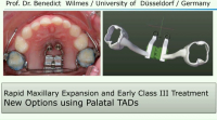 Rapid Maxillary Expansion and Early Class III Treatment: New Options using Palatal TADs