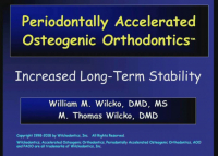Long Term Results of Periodontally Accelerated Osteogenic Orthodontic Procedures