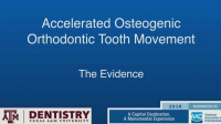 Accelerated Osteogenic Orthodontic Tooth Movement: The Evidence