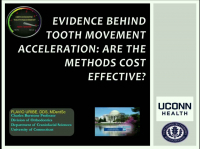 Evidence Behind Tooth Movement Acceleration: Are the Methods Cost Effective?