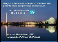 Orthodontic Treatment of Adults with Periodontal Disease; Long-term Follow-up, 19 to 36 years