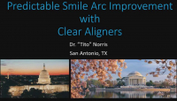 Establishing Consonant Smile Arcs with Clear Aligner Therapy