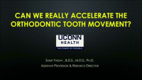 Can We Really Accelerate Orthodontic Tooth Movement