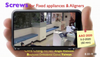TAD Mechanics for Fixed Appliances and Aligners