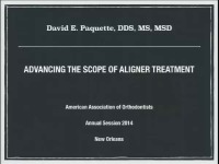 2014 Annual Session - Advancing the Scope of Aligner Treatment / On the Nature of Aligner Performance