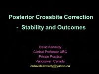 2012 Joint AAO-AAPD Conference - Stability of Posterior Cross Bite Correction