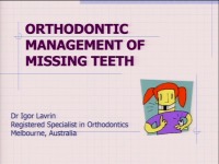 2015 AAO Annual Session - Orthodontic Management of Missing Teeth