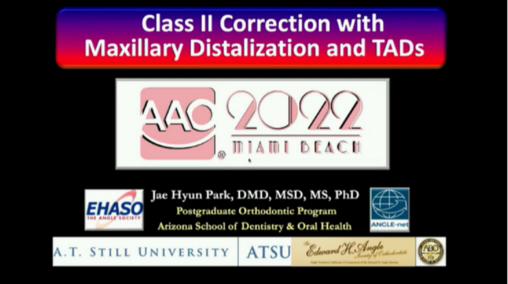 Class II Correction with Maxillary Distalization & TADs