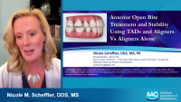 Anterior Open Bite Treatment and Stability Outcomes Using TADs and Aligners vs Aligners Alone icon