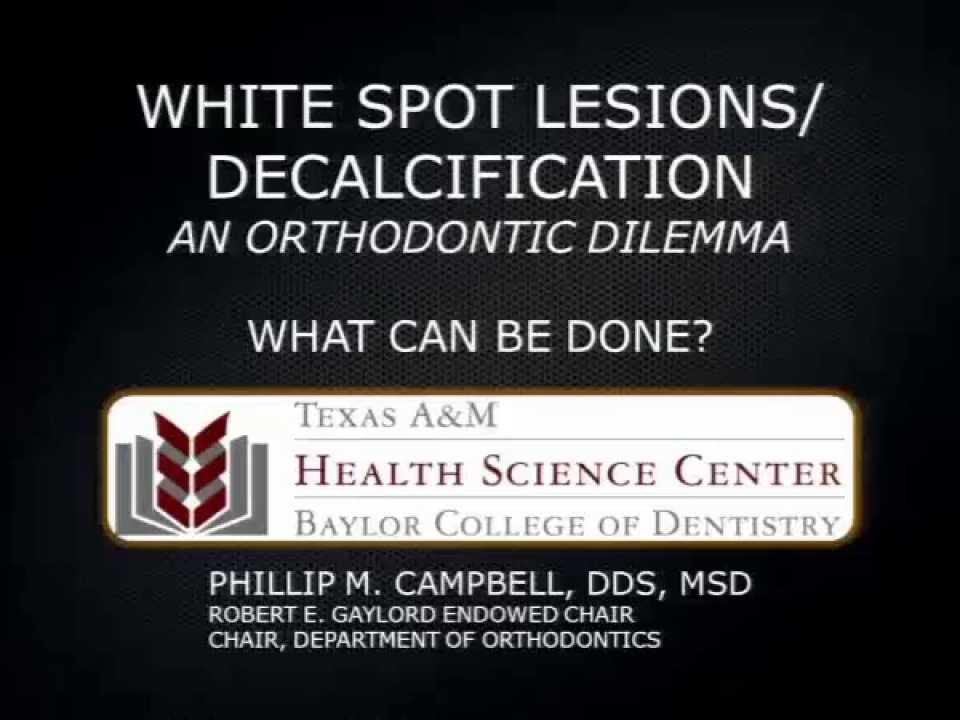 2012 Joint AAOAAPD Conference White Spot Lesions An Orthodontic