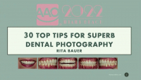 30 Top Tips for Superb Dental Photography
