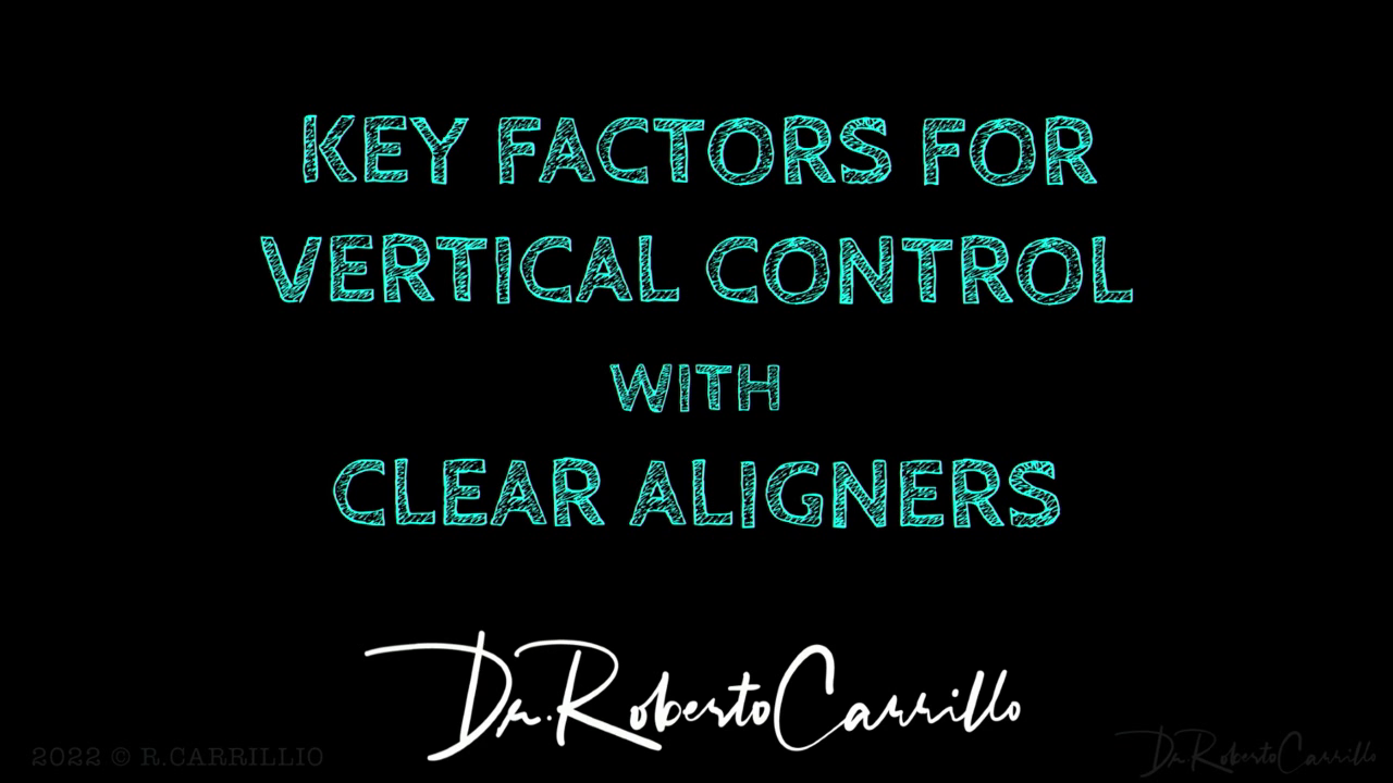 Key Factors for Vertical Control with Clear Aligners American