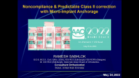 Noncompliance & Predictable Class II Correction with Micro-Implant Anchorage