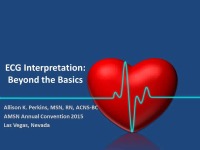 EKG Interpretation: Beyond the Basics
