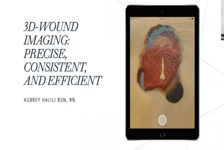 3D-Wound Technology: Precise, Consistent, and Efficient