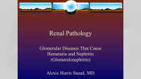 Renal Pathology in Glomerular Disease