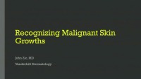 Recognizing Malignant Skin Growths