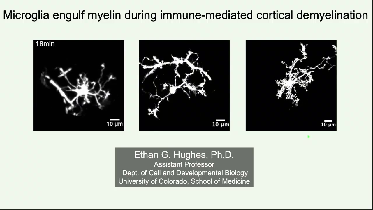 Short Talk: Microglia Engulf Myelin During Immune-Mediated Cortical ...