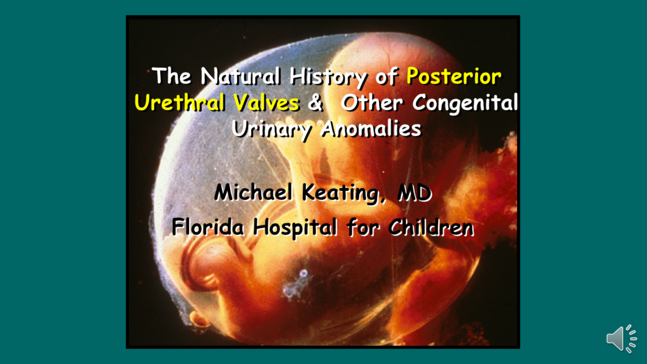 Posterior Urethral Valves and other Causes of Antenatal Hydronephrosis – Have We Changed the Natural History of Congenital Urinary Anomalies