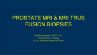 MRI/TRUS Fusion Prostate Biopsy icon