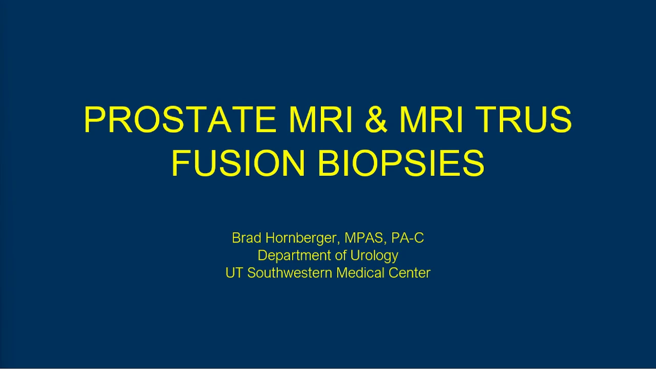 mri-trus-fusion-prostate-biopsy