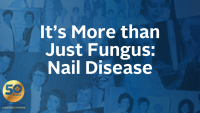 It’s More than Just Fungus: Nail Disease icon