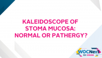 Kaleidoscope of Stoma Mucosa: Normal or Pathergy?