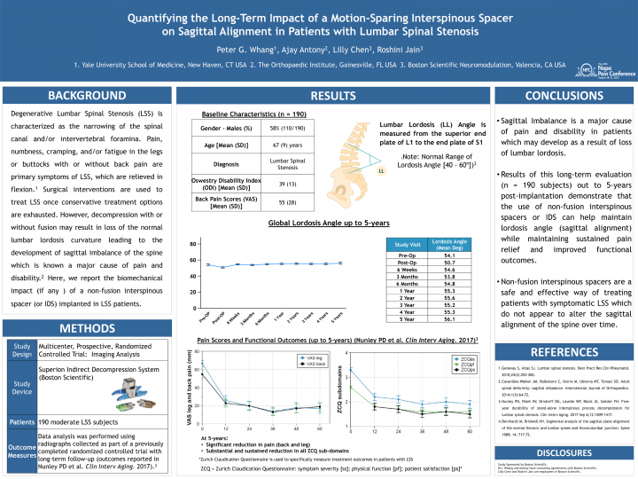 Quantifying the Long-Term Impact of a Motion-Sparing Interspinous Spacer on Sagittal Alignment in Patients with Lumbar Spinal Stenosis
